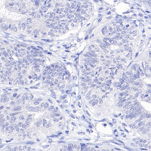 ASGR1 Rabbit Polyclonal Antibody