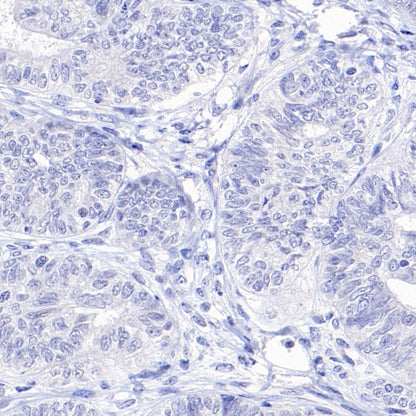 ASGR1 Rabbit Polyclonal Antibody