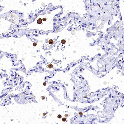 Progranulin Recombinant Rabbit mAb (S-2202-46)