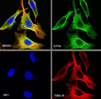 eIF5A Rabbit Polyclonal Antibody