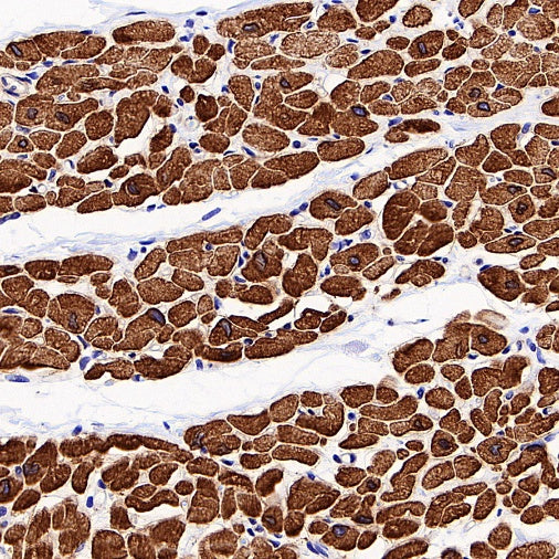 SERCA2 ATPase Recombinant Rabbit mAb (S-5956)