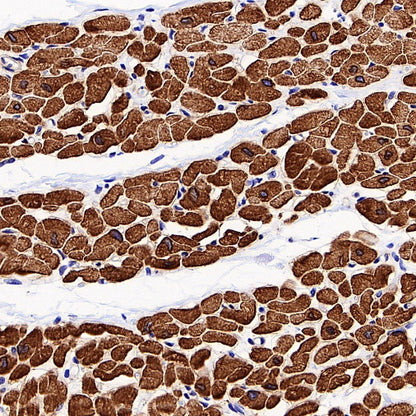 SERCA2 ATPase Recombinant Rabbit mAb (S-5956)