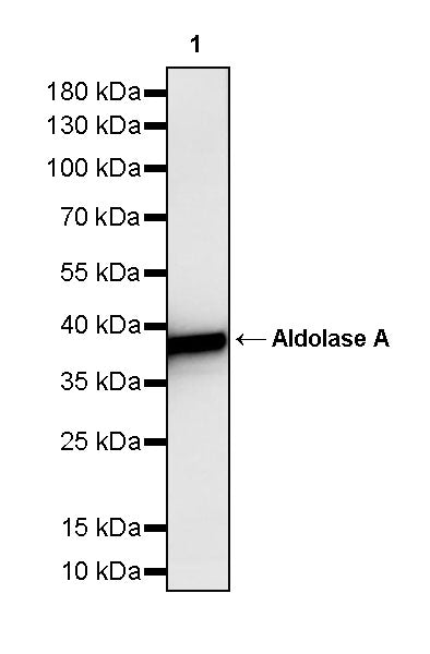 Aldolase A Recombinant Rabbit mAb (S-4007-23)
