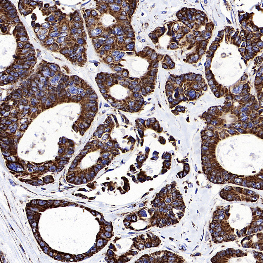 MTCO2 Recombinant Rabbit mAb (S-1891-72)