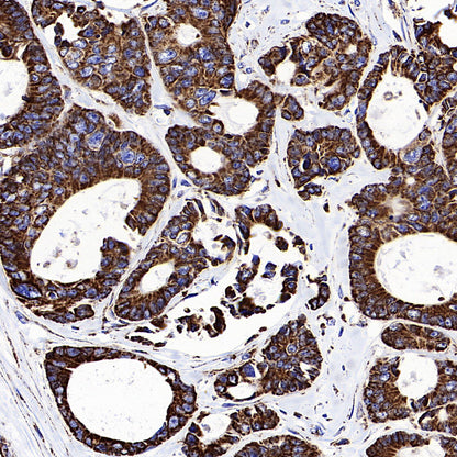 MTCO2 Recombinant Rabbit mAb (S-1891-72)