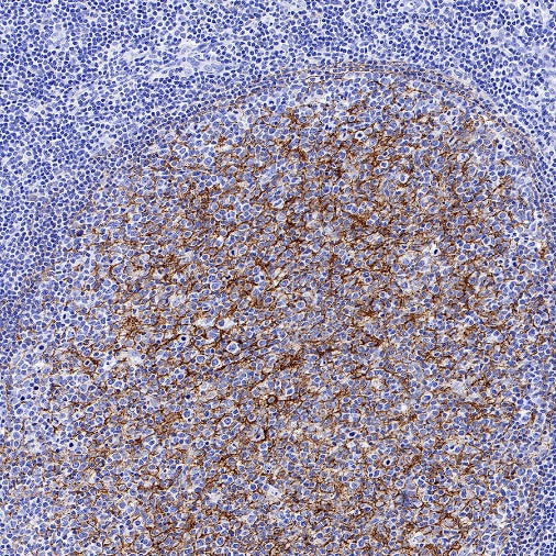 VCAM1 Recombinant Rabbit mAb (S-650-19)