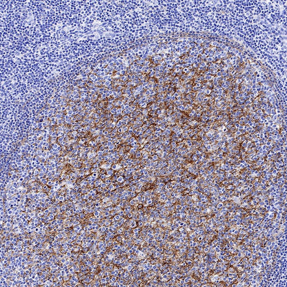 VCAM1 Recombinant Rabbit mAb (S-650-19)