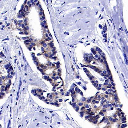 ErbB3 Recombinant Rabbit mAb (SDT-991-73)