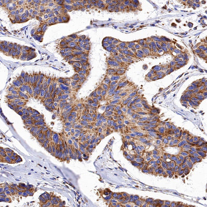 SDHB Recombinant Rabbit mAb (SDT-1162-2)