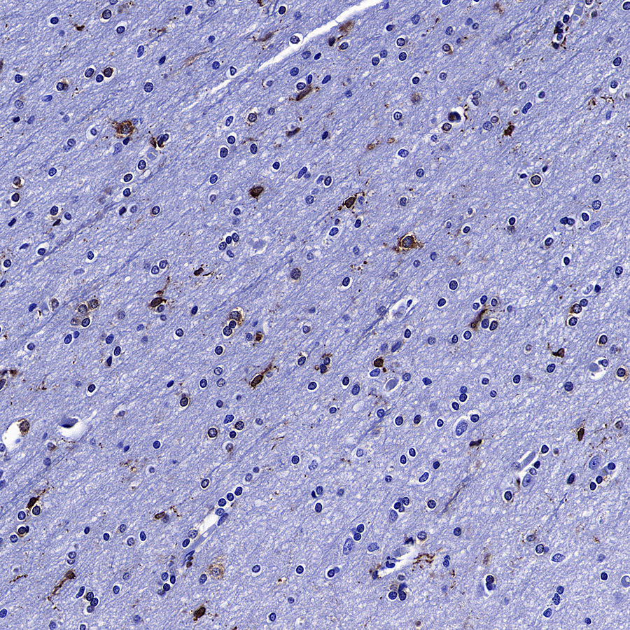 LPCAT2 Recombinant Rabbit mAb (S-4239-18)