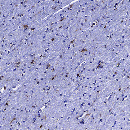 LPCAT2 Recombinant Rabbit mAb (S-4239-18)