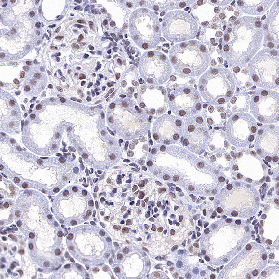 PTBP1 Rabbit Polyclonal Antibody