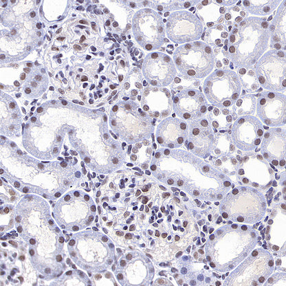 PTBP1 Rabbit Polyclonal Antibody