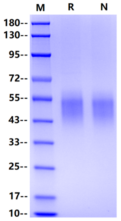 DNAM-1/CD226 His Tag Protein, Human