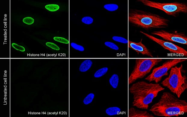 Histone H4 (acetyl K20) Recombinant Rabbit mAb (S-846-491)