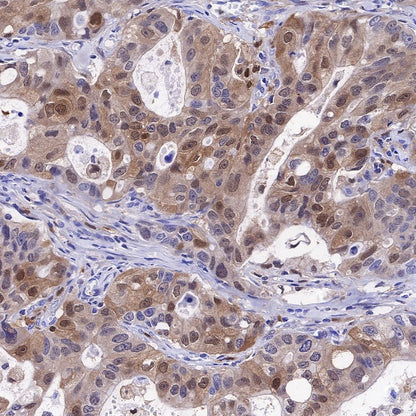 IL-18 Recombinant Rabbit mAb (S-2142-2)