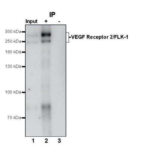 VEGF Receptor 2/FLK-1 Recombinant Rabbit mAb (S-1519-34)