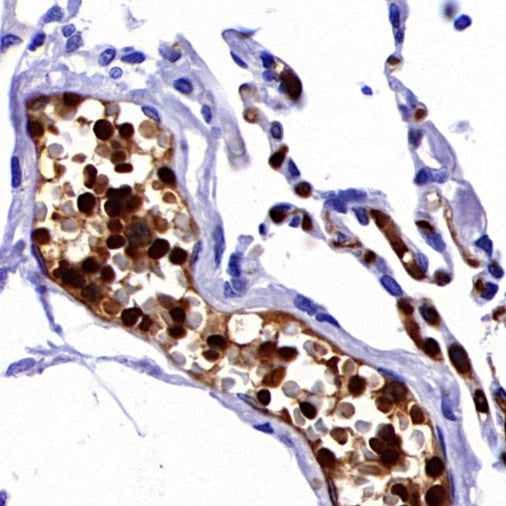 Hemoglobin alpha Recombinant Rabbit mAb (S-R242)