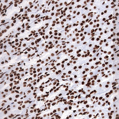 Histone H3 (acetyl K9) Rabbit polyclonal antibody