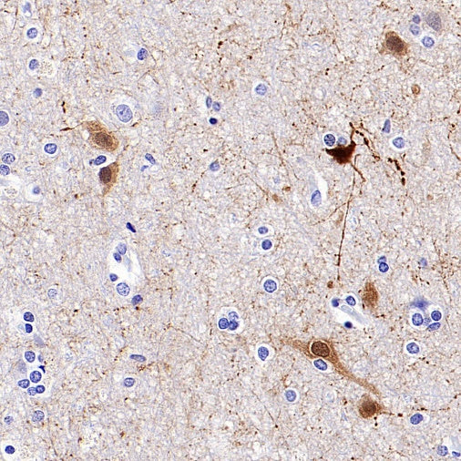 Calbindin Recombinant Rabbit mAb (S-774-378)