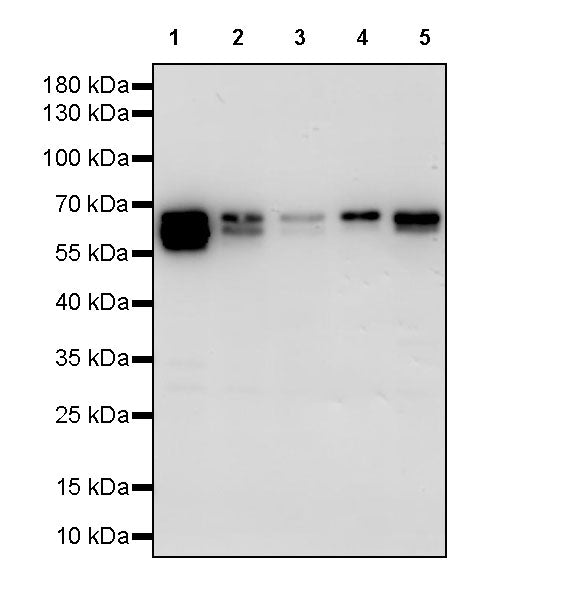 STK39 Recombinant Rabbit mAb (S-3630-15)