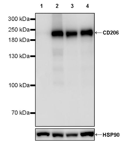 CD206 Recombinant Rabbit mAb (S-3477-27)