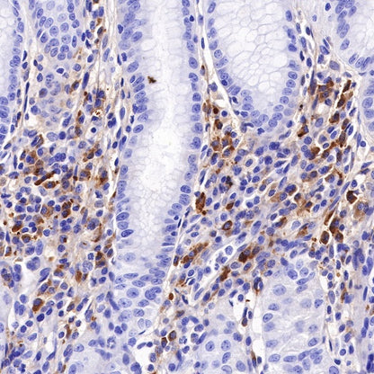 Kappa light chain Recombinant Rabbit mAb (S-385-23)