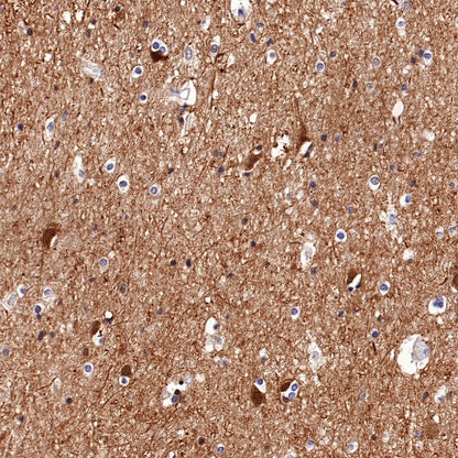 PGP9.5 Recombinant Rabbit mAb (SDT-665-37)