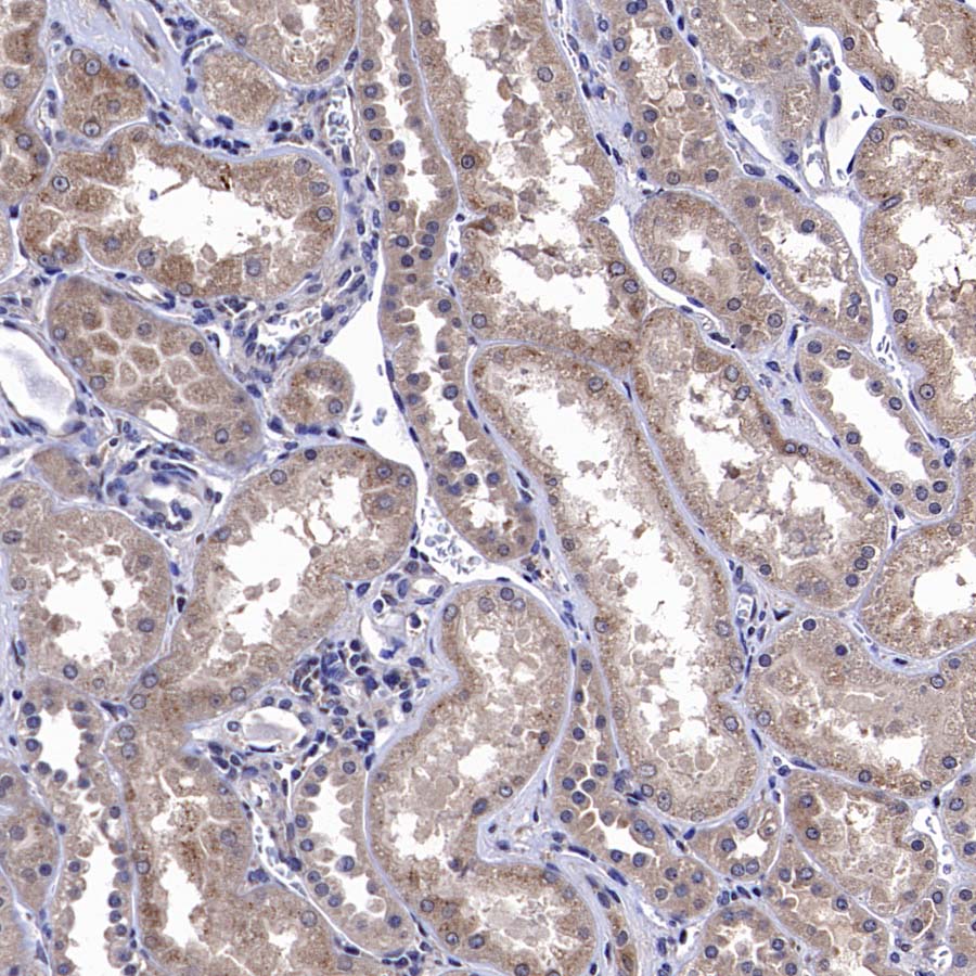 CGREF1 Recombinant Rabbit mAb (S-4558-25)