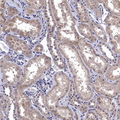 CGREF1 Recombinant Rabbit mAb (S-4558-25)