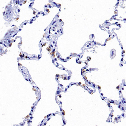 NaPi2b/SLC34A2 Recombinant Rabbit mAb (SDT-1771-79)