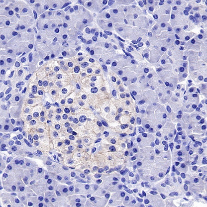 ROR1 Recombinant Rabbit mAb (SDT-R502)