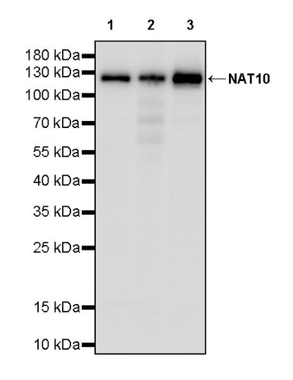 NAT10 Recombinant Rabbit mAb (S-2547-125)