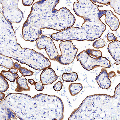 EPCR/PROCR (CD201) Rabbit Polyclonal Antibody
