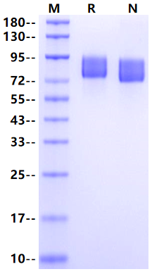 CD117/c-Kit His Tag Protein, Human