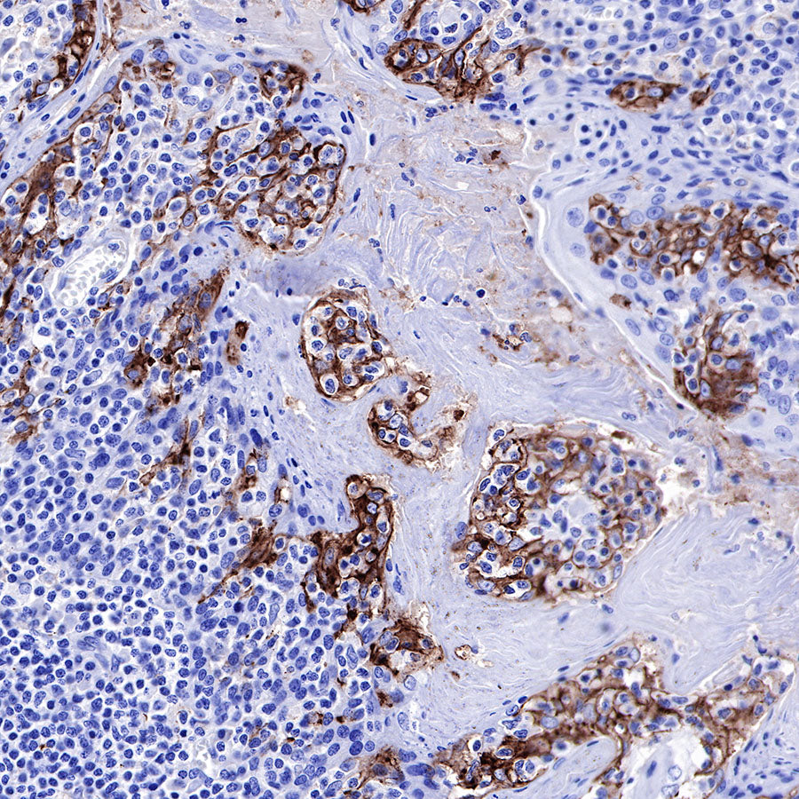 PD-L1 Recombinant Rabbit mAb,PBS Only (SDT-R017)