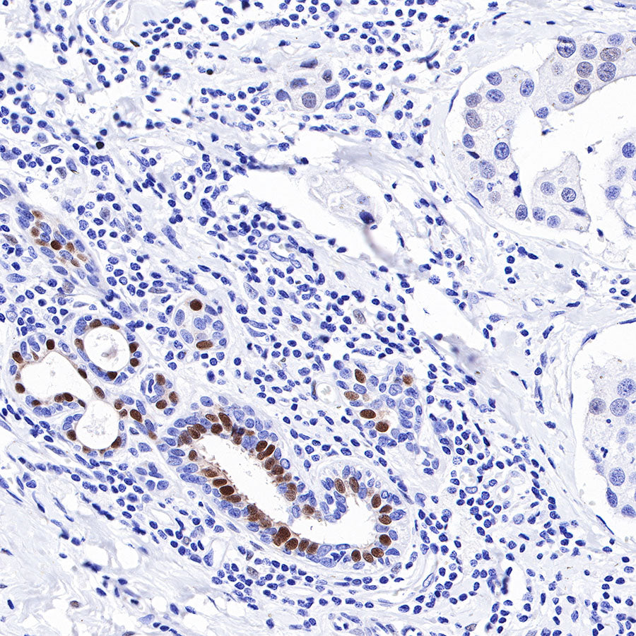 Androgen Receptor Recombinant Rabbit mAb (SDT-R157)