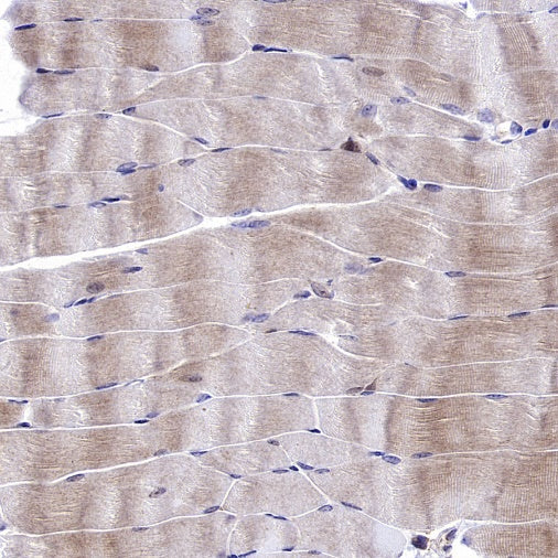 GABARAP Recombinant Rabbit mAb (S-2372-47)