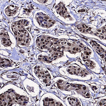 eIF6 Recombinant Rabbit mAb (S-4171-13)