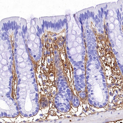 COL1A1 Recombinant Rabbit mAb (S-2975-9)