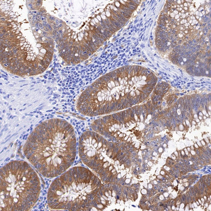 NQO1 Recombinant Rabbit mAb (S-1672-2)