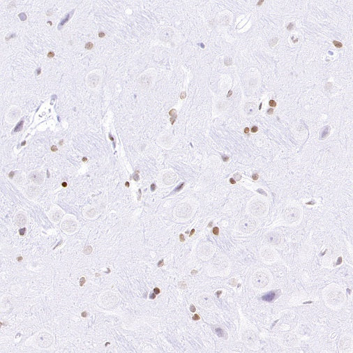Histone H3 (acetyl K4) Recombinant Rabbit mAb (S-848-137)