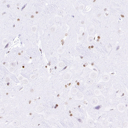 Histone H3 (acetyl K4) Recombinant Rabbit mAb (S-848-137)