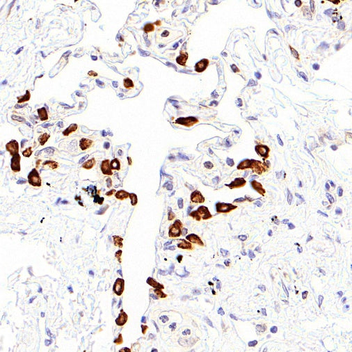 LPCAT1 Recombinant Rabbit mAb (S-6053)