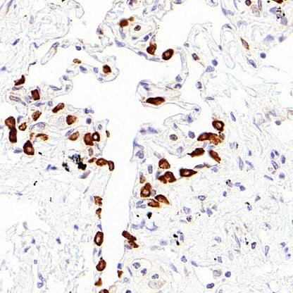 LPCAT1 Recombinant Rabbit mAb (S-6053)