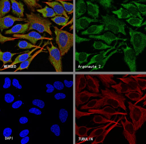 Argonaute 2 Recombinant Rabbit mAb (S-2620-13)