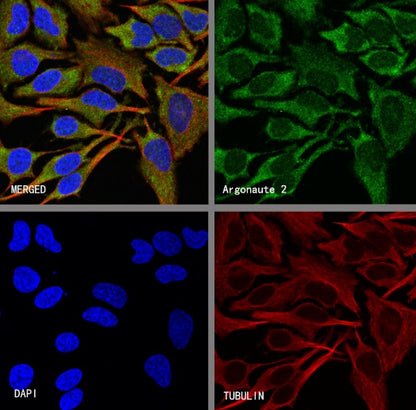 Argonaute 2 Recombinant Rabbit mAb (S-2620-13)