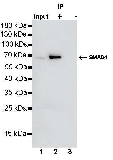 SMAD4 Recombinant Rabbit mAb (SDT-168-62)