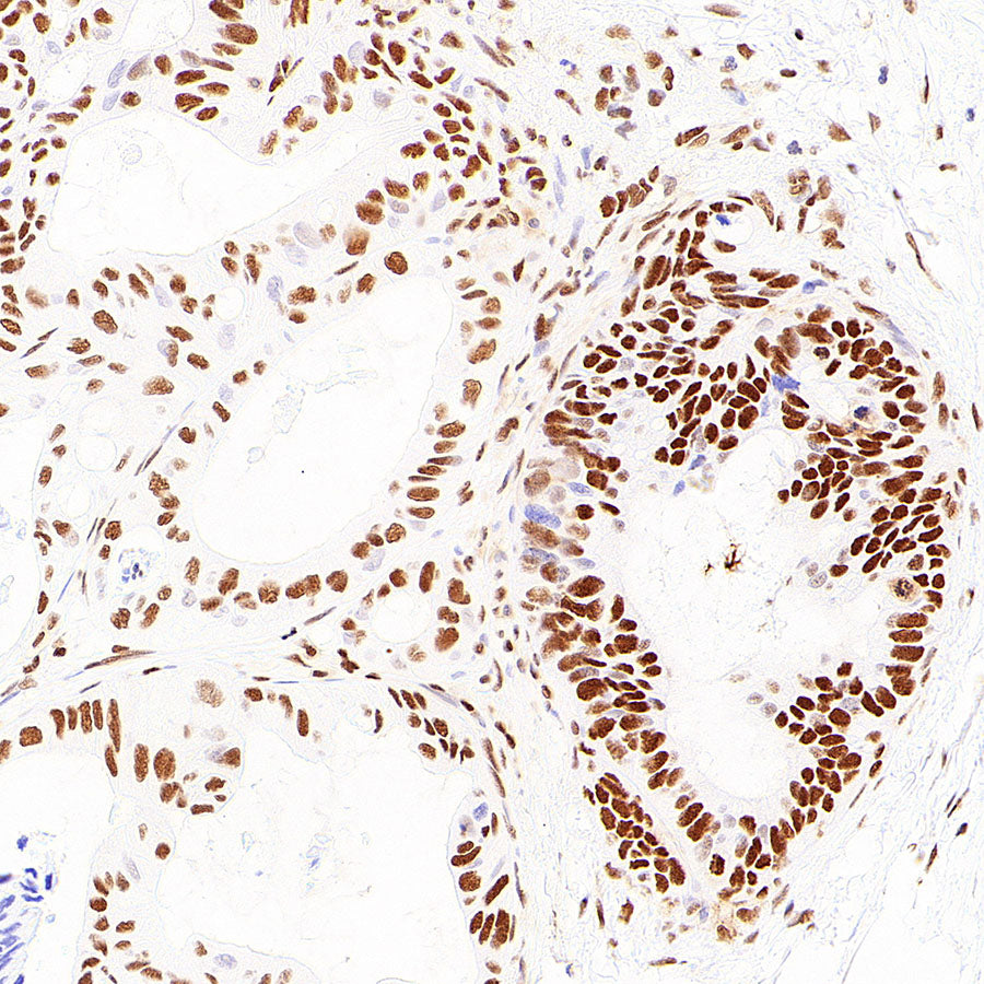 pan Brd4 Recombinant Rabbit mAb (S-6208)