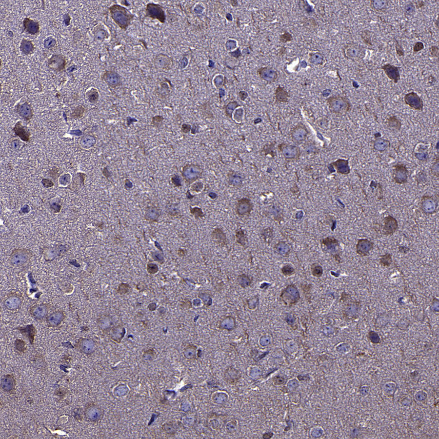 CAPRIN1 Mouse mAb